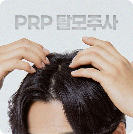 줄기세포 탈모주사